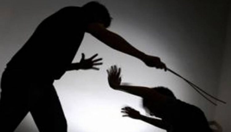 20 روپے چوری کا الزام ۔۔دکاندار کا 10سالہ بچے پر تشدد۔۔آنکھ پھوڑ دی