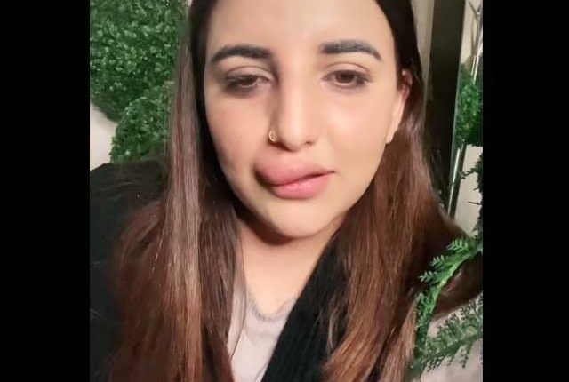 حریم شاہ کی ادھوری سرجری کے باعث ہونٹوں کی حالت بگڑ گئی
