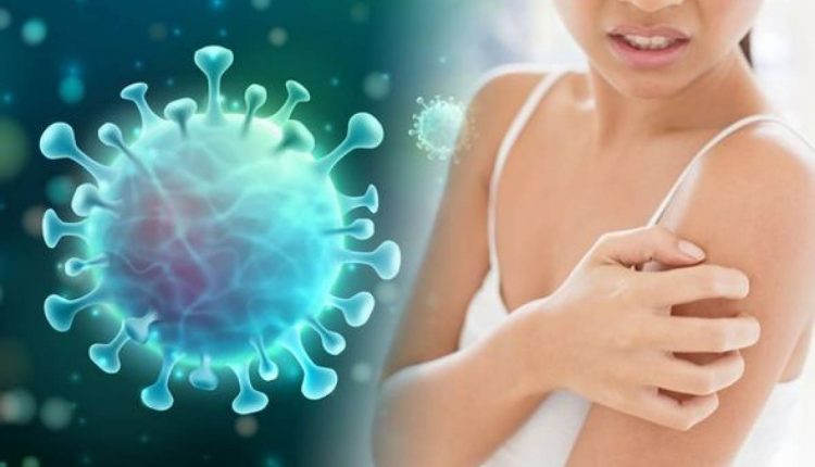 سرخ ا نکھیں اور جلد کی خارش بھی اومی کرون کی علامات قرار