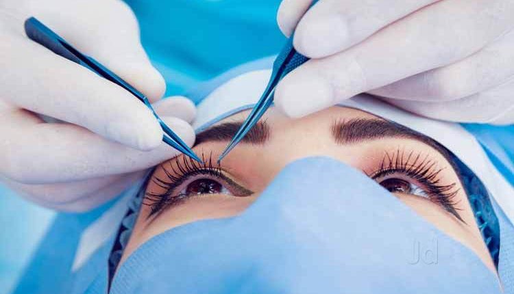 3 زندہ مکھیاں امریکی خاتون کی آنکھ سے نکال لی گئیں