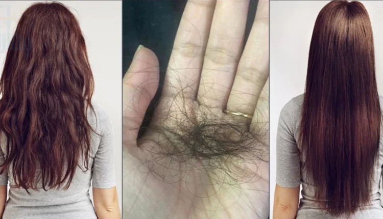 ری بونڈنگ کے بعد بال کیوں گر رہے ہیں؟ جانیئے