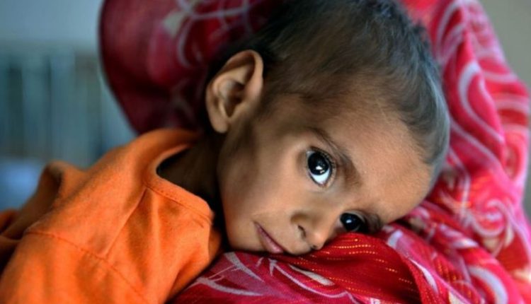 بلوچستان،بچوں میں غذائیت کی صورتحال تشویشناک، 4 سال گزرنے کے باوجودنیوٹریشن ایمرجنسی فنڈز ریلیز نہ ہوسکے