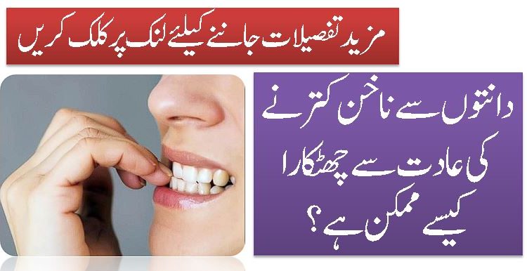 دانتوں سے ناخن کترنے کی عادت سے چھٹکارا کیسے ممکن ہے؟